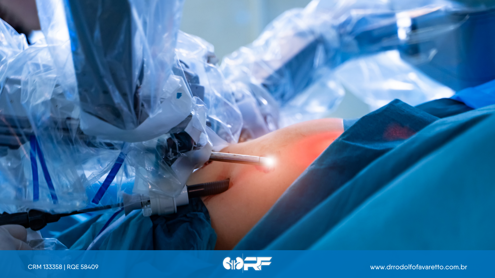 Cirurgia robótica na urologia